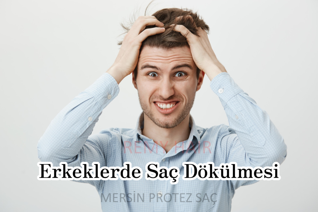 Erkeklerde Saç Dökülmesi