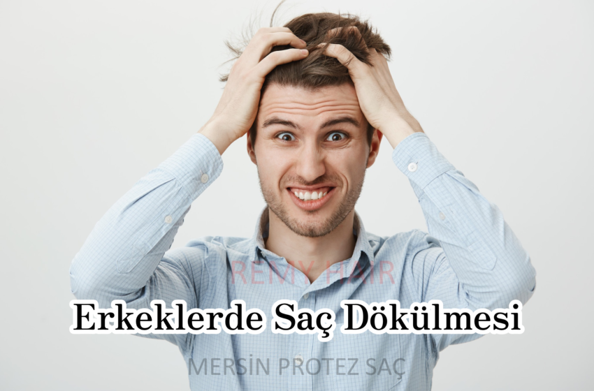 Erkeklerde Saç Dökülmesi