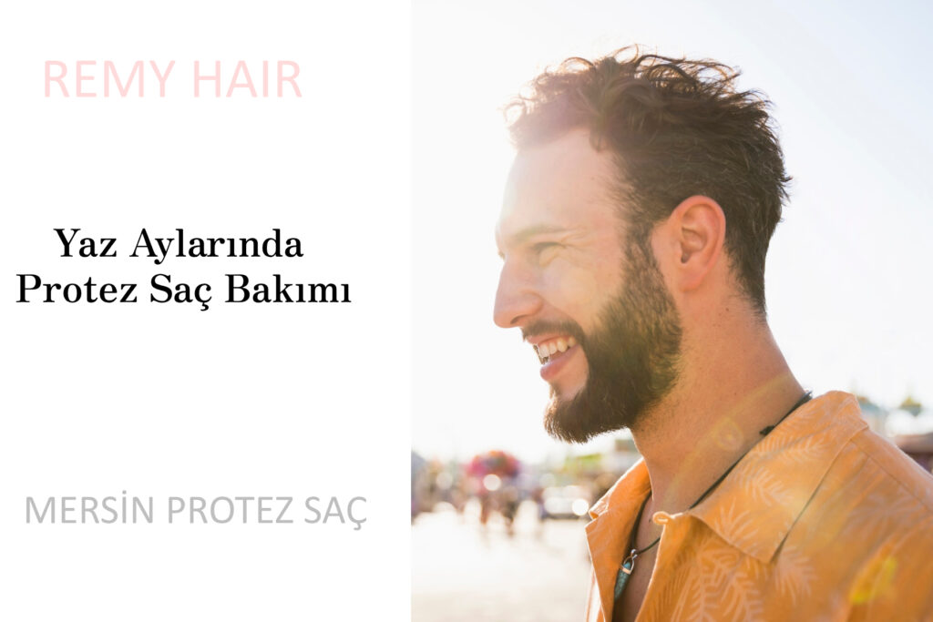 Yaz Aylarında Protez Saç Bakımı