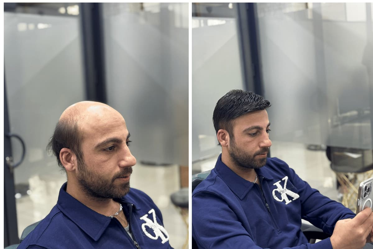 yenisehir-mersin-protez-sac-merkezi